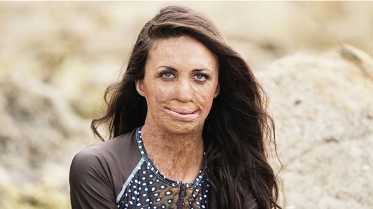 The Sky's The Limit: Turia Pitt Leads Fundraising Trek to Everest